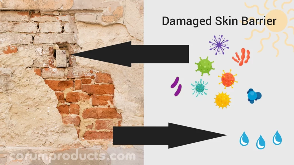 Skin Barrier Damage is like a crumbling brick wall