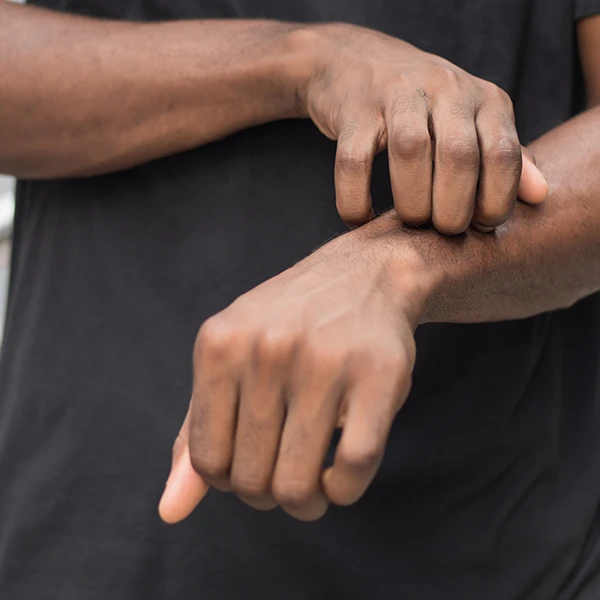 black-man-scraching-itchy-wrist-from-dry-skin-needs-dry-skin-care-routine