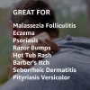 corum-soothing-malassezia-moisturizer-peppermint-benefits-sizes
