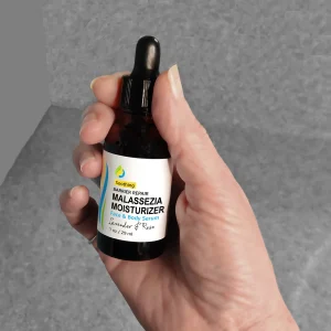 hand-holding-corum-soothing-malassezia-moisturizer-safe-jasmine-treatment-anti-itch-1oz