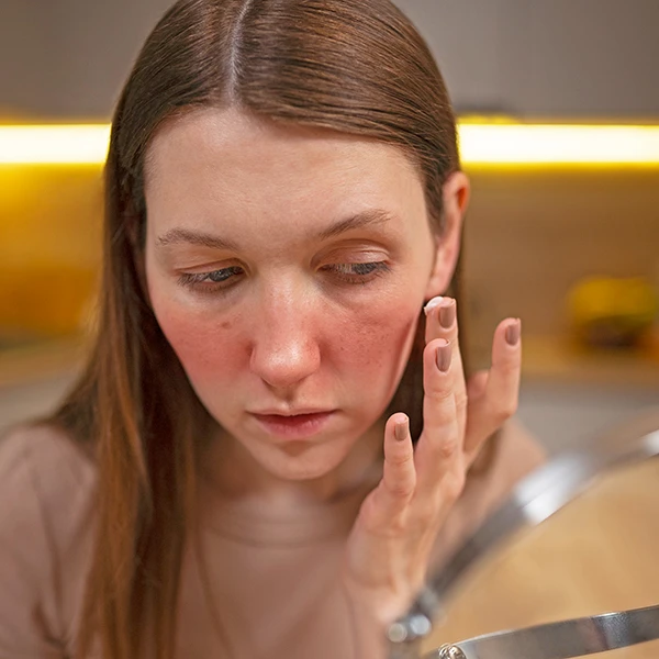 woman-using-medicine-help-with-damaged-skin-barrier